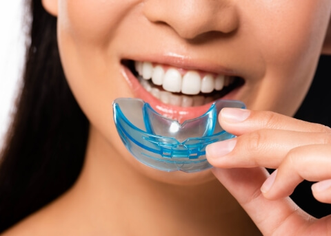 Smiling woman holding a blue mouthguard
