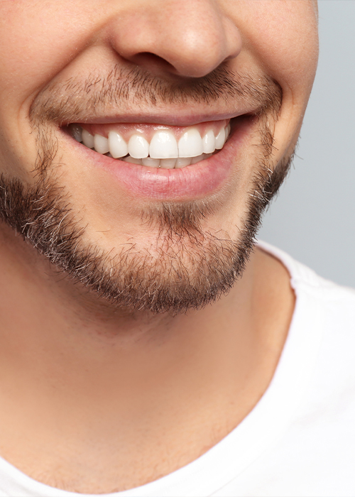 Close up of man with short beard smiling after restorative dentistry in Cumming