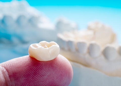 Close up of a dental crown resting on a finger