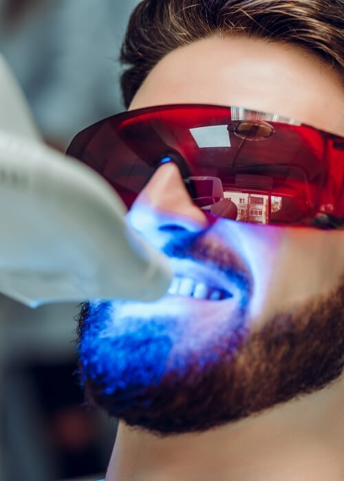 Man in dental chair getting professional teeth whitening in Cumming
